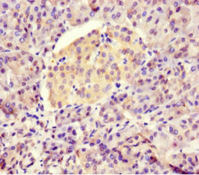 BTNL2 Antibody in Immunohistochemistry (Paraffin) (IHC (P))