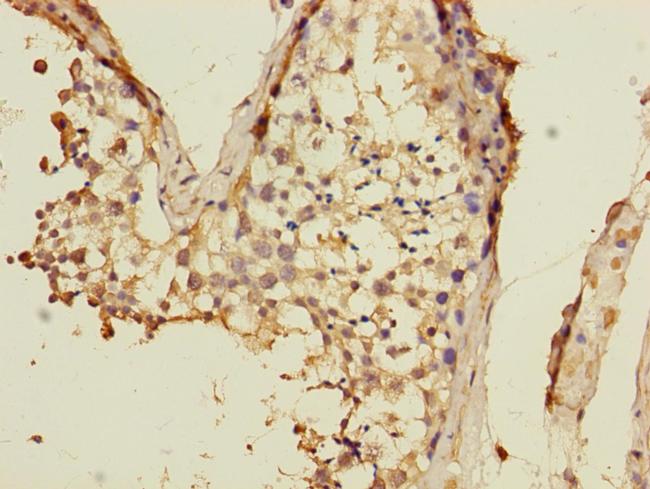 VPS33B Antibody in Immunohistochemistry (Paraffin) (IHC (P))