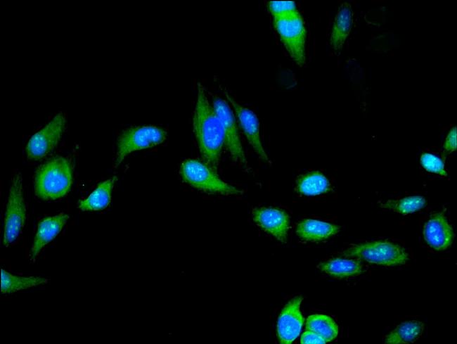 UFSP2 Antibody in Immunocytochemistry (ICC/IF)