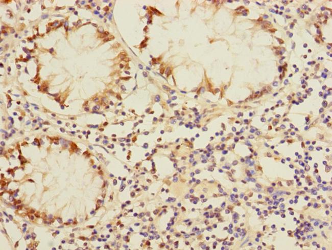 DUSP16 Antibody in Immunohistochemistry (Paraffin) (IHC (P))