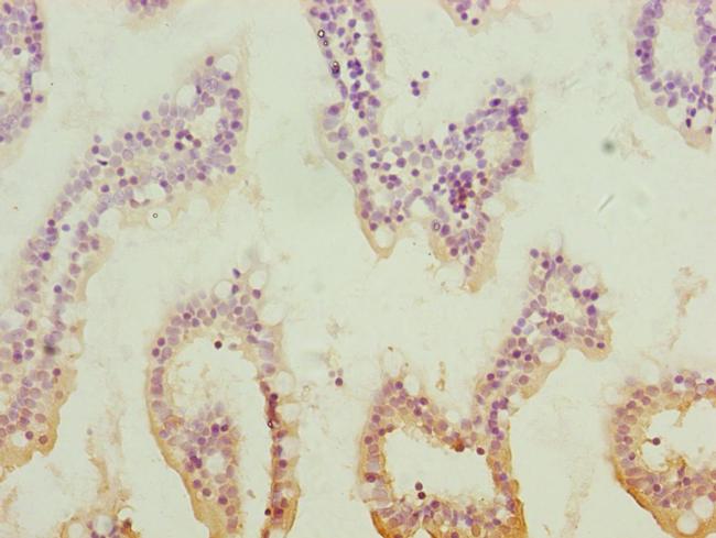 QRSL1 Antibody in Immunohistochemistry (Paraffin) (IHC (P))