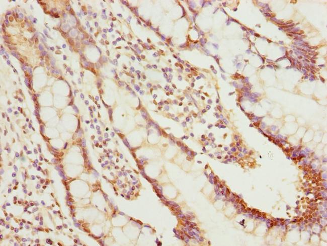 NLE1 Antibody in Immunohistochemistry (Paraffin) (IHC (P))