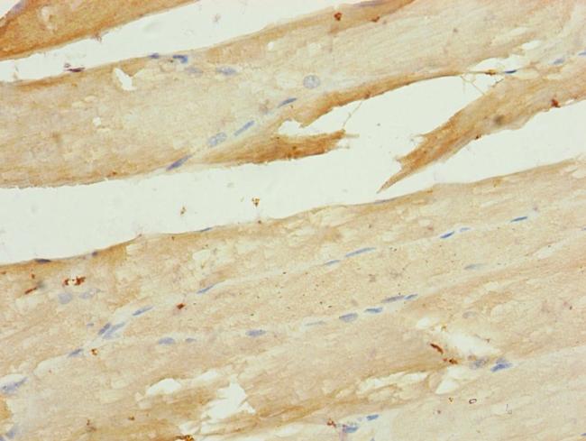 UCRC Antibody in Immunohistochemistry (Paraffin) (IHC (P))