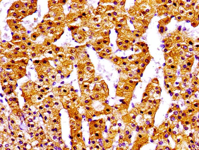 NPC1 Antibody in Immunohistochemistry (Paraffin) (IHC (P))