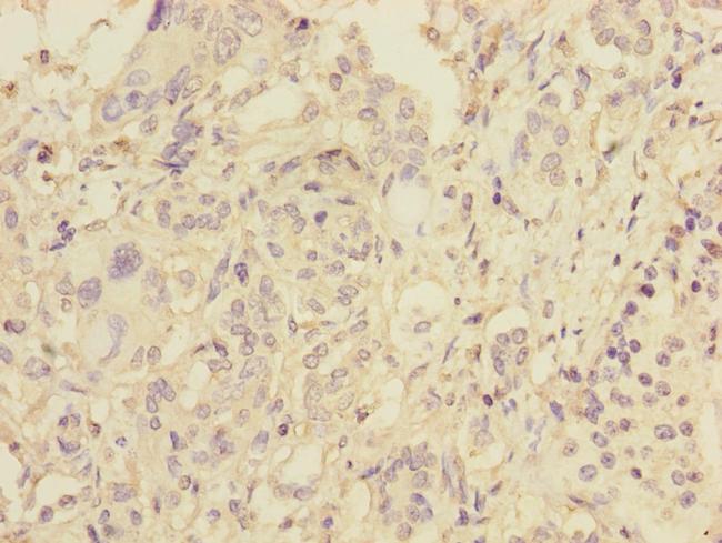 Pallidin Antibody in Immunohistochemistry (Paraffin) (IHC (P))