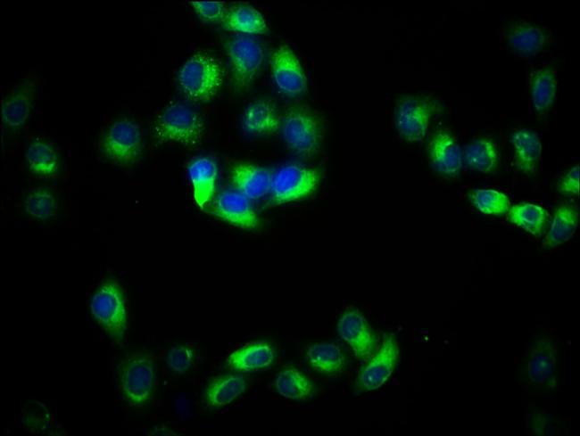 PACSIN2 Antibody in Immunocytochemistry (ICC/IF)