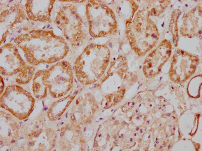 MGAT4B Antibody in Immunohistochemistry (Paraffin) (IHC (P))