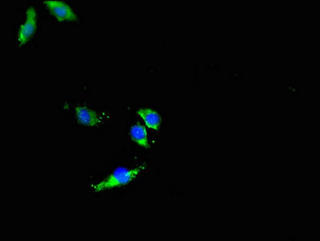 DNMT3L Antibody in Immunocytochemistry (ICC/IF)