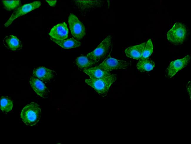 BAIAP2 Antibody in Immunocytochemistry (ICC/IF)