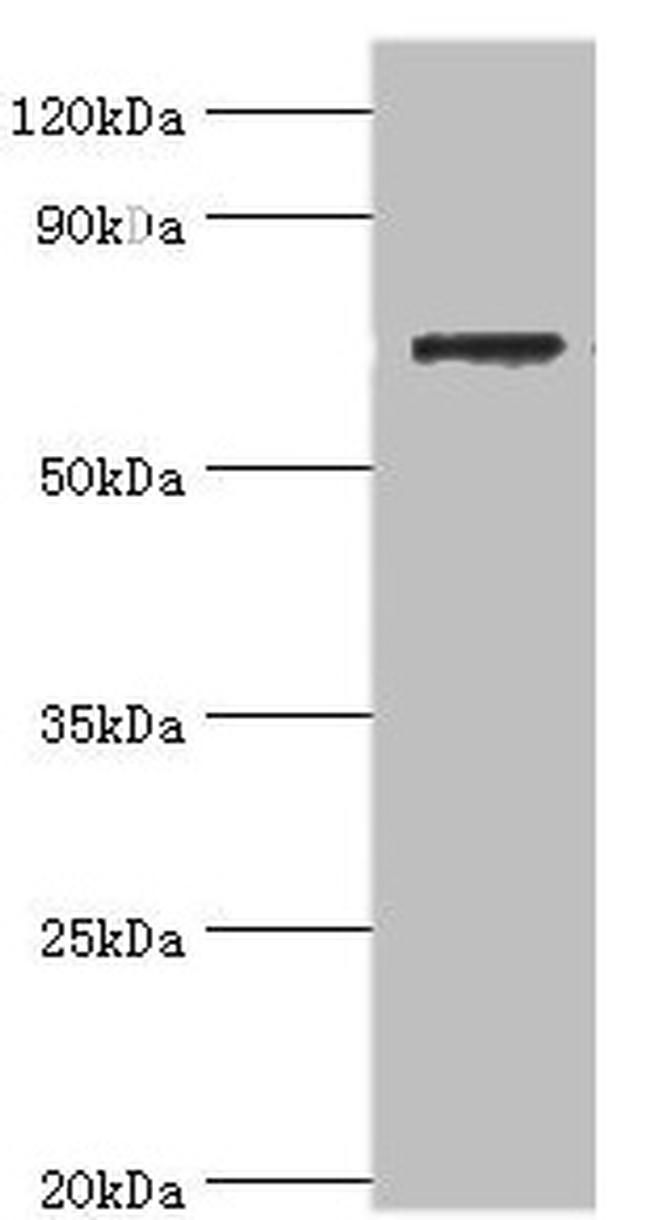 SLC25A13 Antibody in Western Blot (WB)