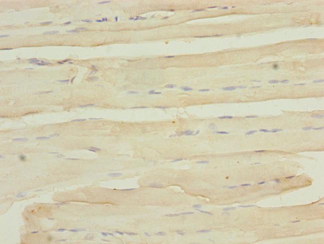 MYO5B Antibody in Immunohistochemistry (Paraffin) (IHC (P))