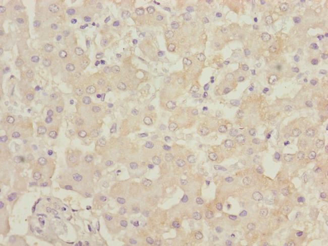 B9D1 Antibody in Immunohistochemistry (Paraffin) (IHC (P))