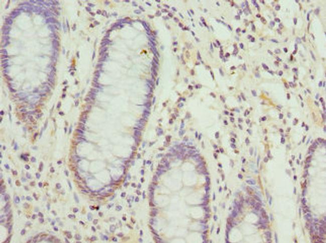 NFS1 Antibody in Immunohistochemistry (Paraffin) (IHC (P))