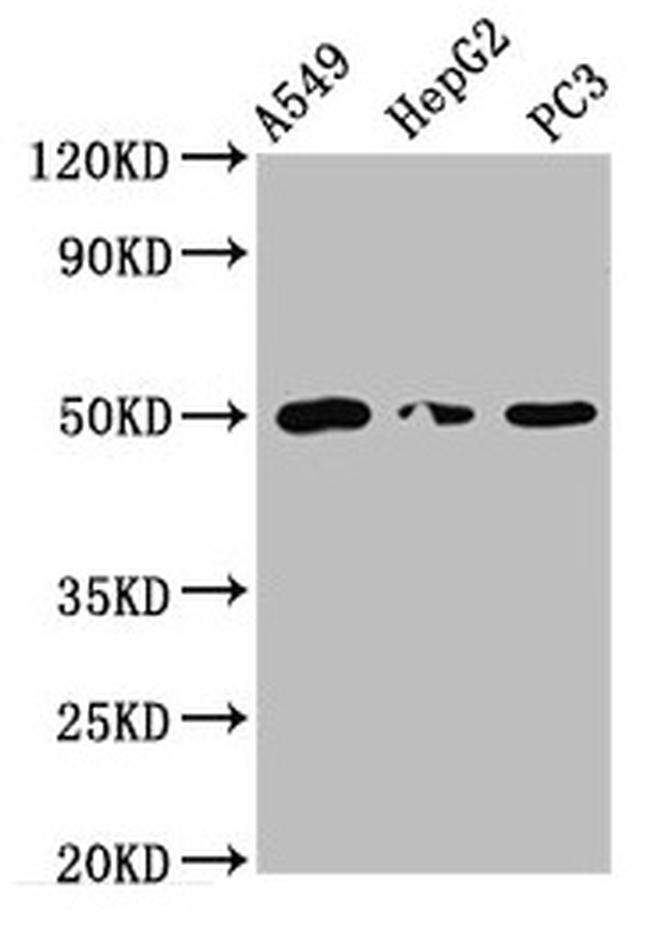 IFT52 Antibody in Western Blot (WB)