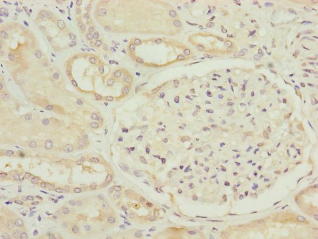 FAM96B Antibody in Immunohistochemistry (Paraffin) (IHC (P))