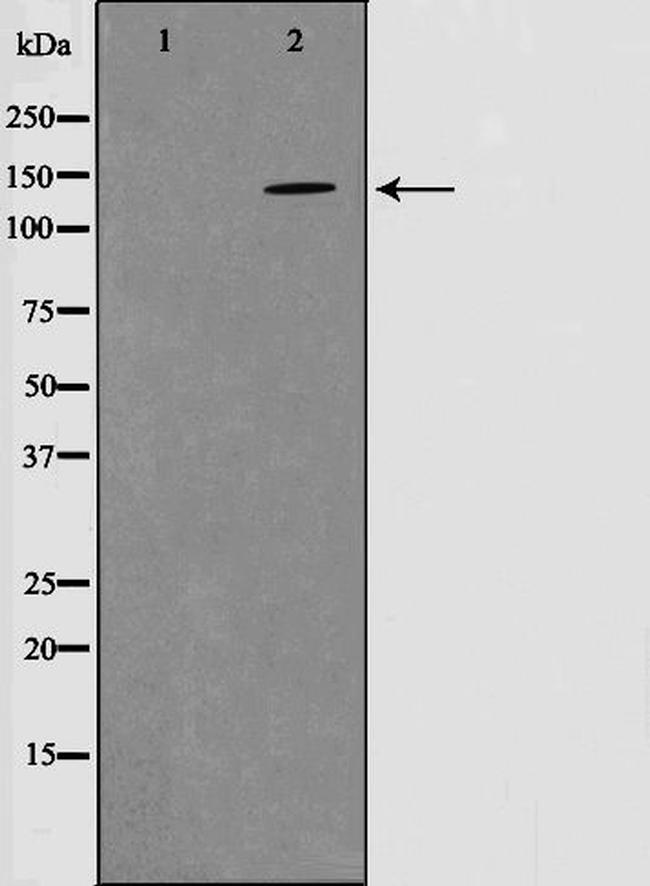 Phospho-PYK2 (Tyr580) Antibody in Western Blot (WB)