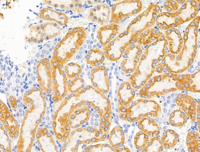 Phospho-EphA2/EphA3/EphA4 (Tyr588, Tyr596) Antibody in Immunohistochemistry (Paraffin) (IHC (P))