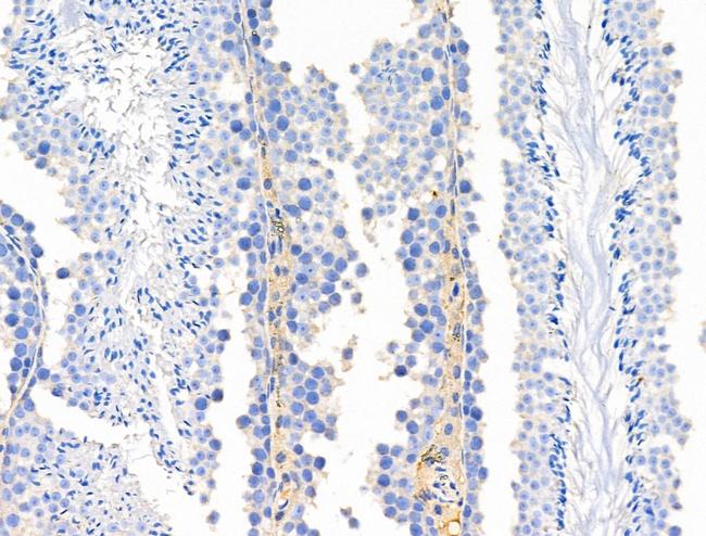 Phospho-eNOS (Ser615) Antibody in Immunohistochemistry (Paraffin) (IHC (P))