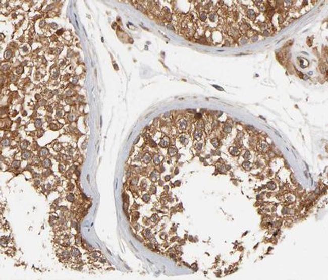 Phospho-FER (Tyr402) Antibody in Immunohistochemistry (Paraffin) (IHC (P))