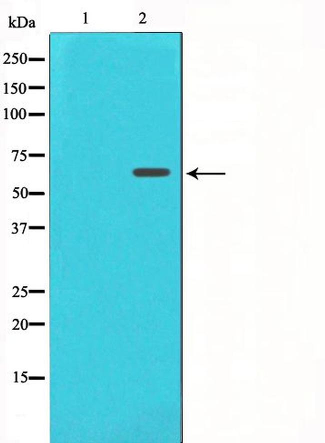 FRS2 Antibody in Western Blot (WB)