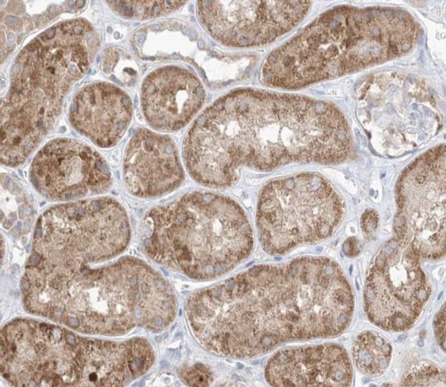 GAB2 Antibody in Immunohistochemistry (Paraffin) (IHC (P))