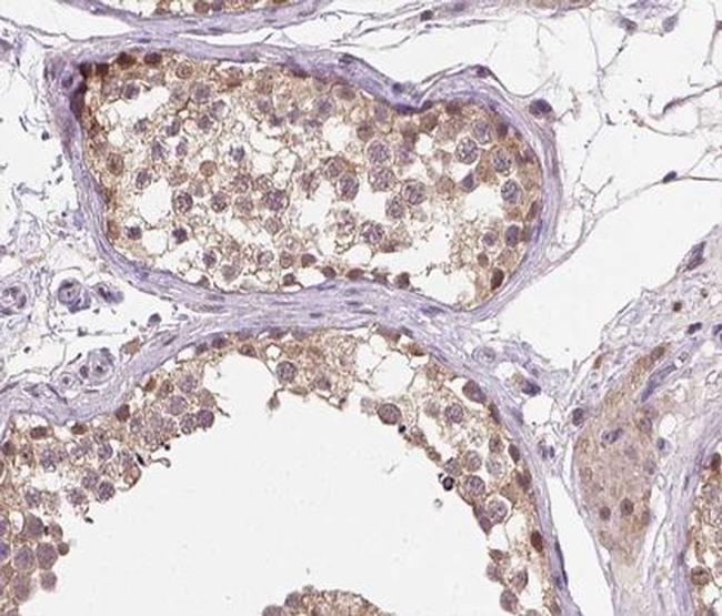 Cyclin A1 Antibody in Immunohistochemistry (Paraffin) (IHC (P))