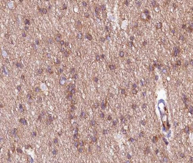 mGluR2/mGluR3 Antibody in Immunohistochemistry (Paraffin) (IHC (P))