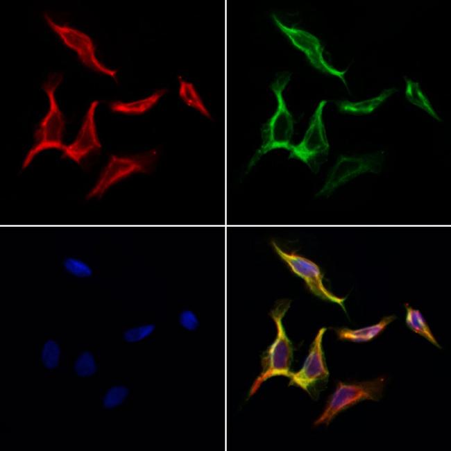 KV3.2 (KCNC2) Antibody in Immunocytochemistry (ICC/IF)