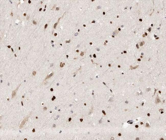 HYD Antibody in Immunohistochemistry (Paraffin) (IHC (P))