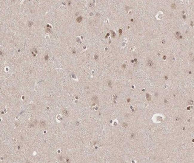 TRADD Antibody in Immunohistochemistry (Paraffin) (IHC (P))