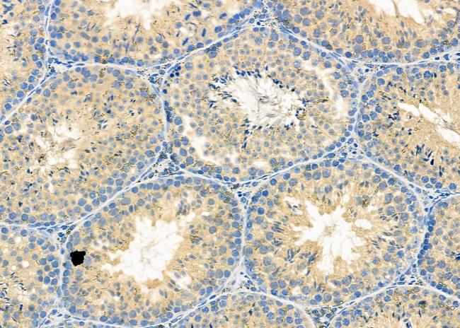 GAK Antibody in Immunohistochemistry (Paraffin) (IHC (P))