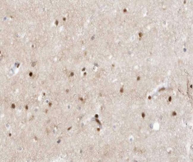 ZIC1/ZIC2/ZIC3 Antibody in Immunohistochemistry (Paraffin) (IHC (P))