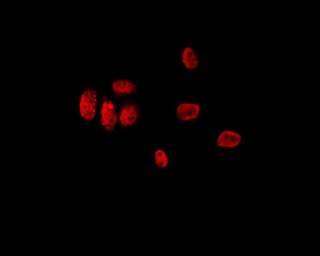 LMX1B Antibody in Immunocytochemistry (ICC/IF)