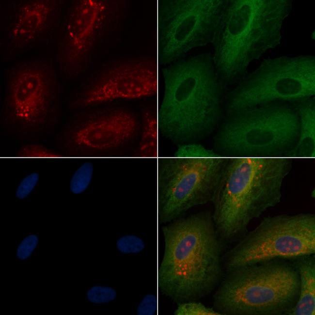 Thrombin Antibody in Immunocytochemistry (ICC/IF)