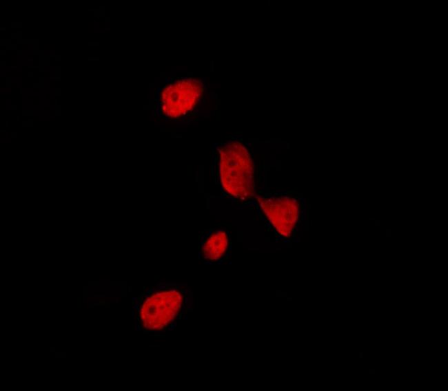 TFE3 Antibody in Immunocytochemistry (ICC/IF)