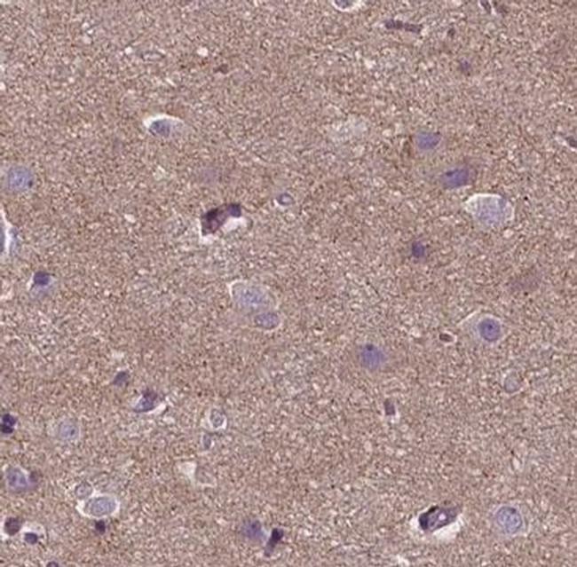 ACTG2 Antibody in Immunohistochemistry (Paraffin) (IHC (P))