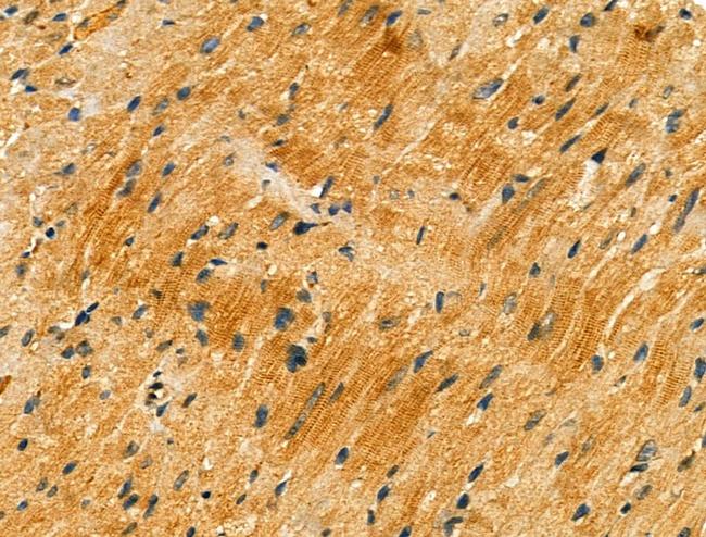 FKRP Antibody in Immunohistochemistry (Paraffin) (IHC (P))