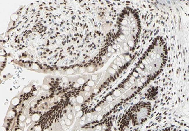 DNA-PK Antibody in Immunohistochemistry (Paraffin) (IHC (P))