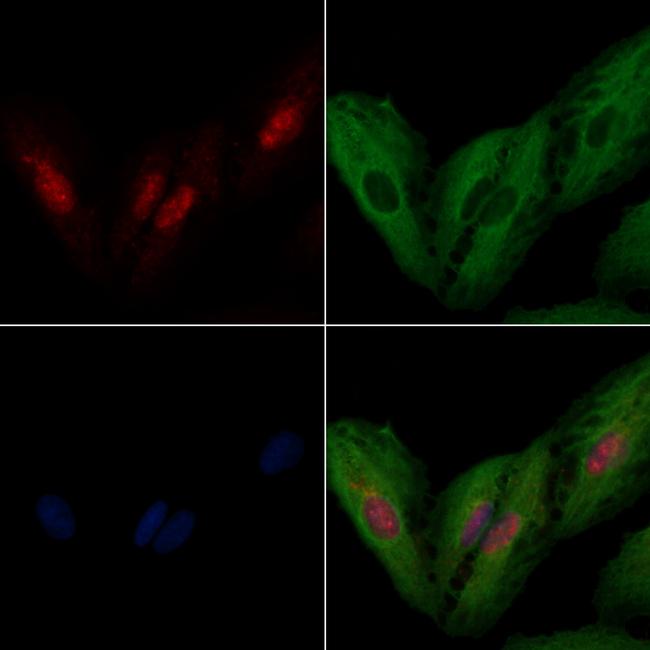 IRX2 Antibody in Immunocytochemistry (ICC/IF)