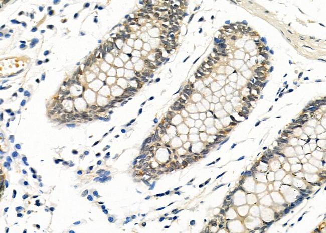 EGR1 Antibody in Immunohistochemistry (Paraffin) (IHC (P))