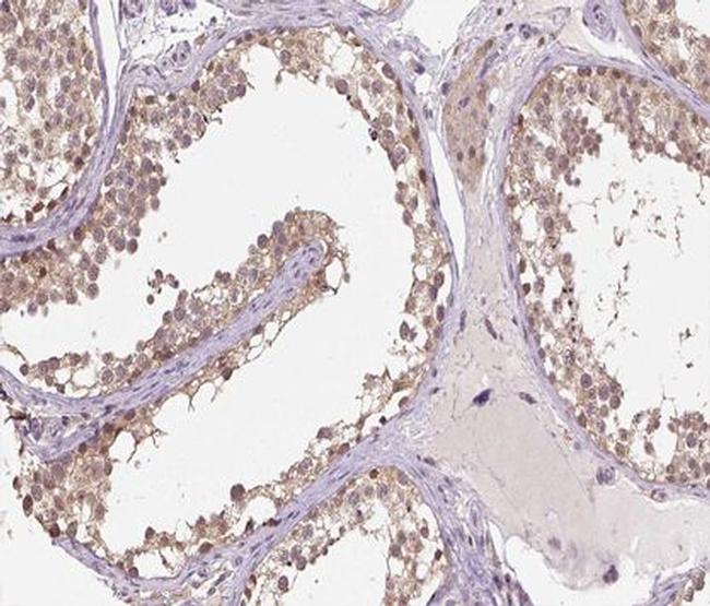 HSPH1 Antibody in Immunohistochemistry (Paraffin) (IHC (P))