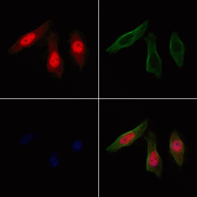 SPDL1 Antibody in Immunocytochemistry (ICC/IF)