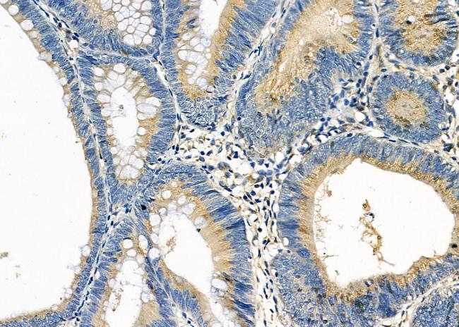 CYP2B6 Antibody in Immunohistochemistry (Paraffin) (IHC (P))