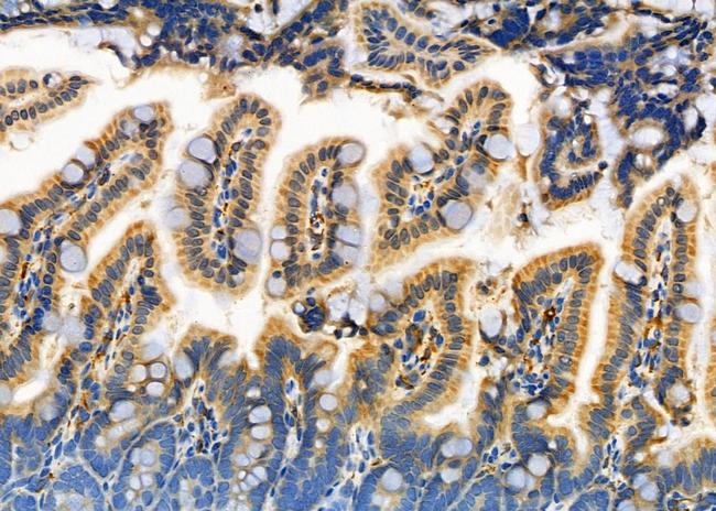 ELOVL1 Antibody in Immunohistochemistry (Paraffin) (IHC (P))