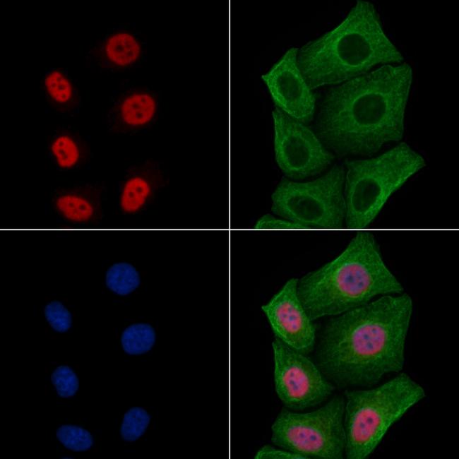 FOXL1 Antibody in Immunocytochemistry (ICC/IF)