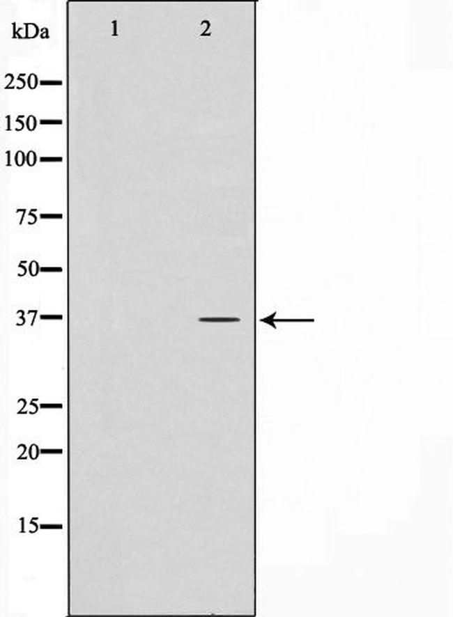 CTU1 Antibody in Western Blot (WB)