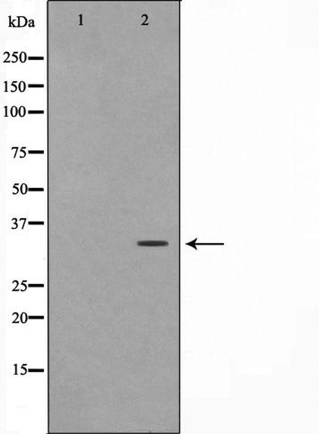 FOXE1 Antibody in Western Blot (WB)