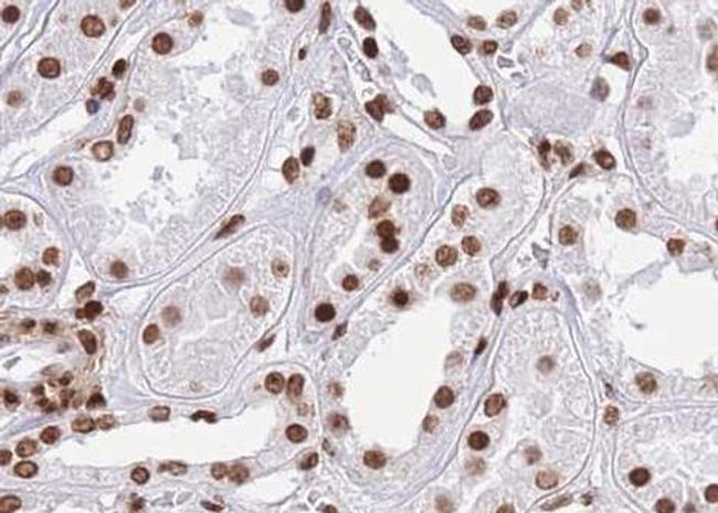 Phospho-CtBP1 (Ser422) Antibody in Immunohistochemistry (Paraffin) (IHC (P))