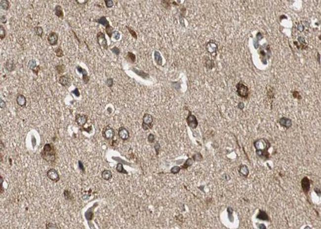 Phospho-NMDAR1 (Ser897) Antibody in Immunohistochemistry (Paraffin) (IHC (P))