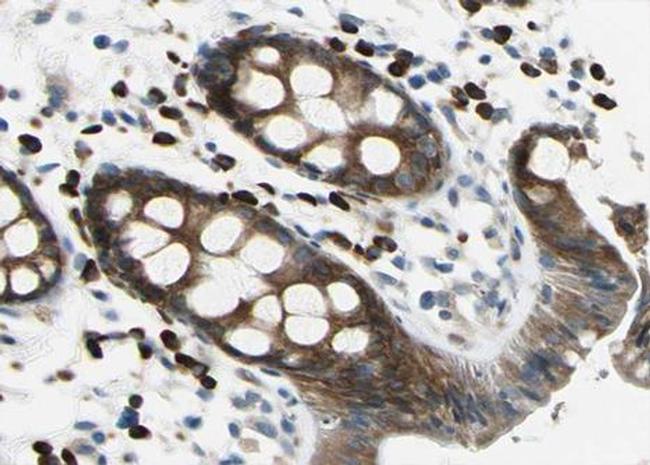 Phospho-Protein APC (Ser2054) Antibody in Immunohistochemistry (Paraffin) (IHC (P))